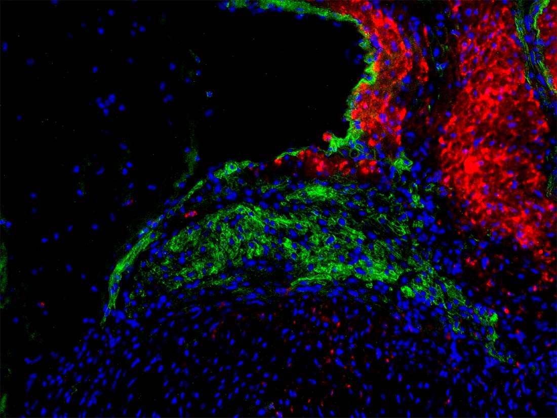 Mouse atrioventricular (AV) node Photo of Mouse atrioventricular (AV) node