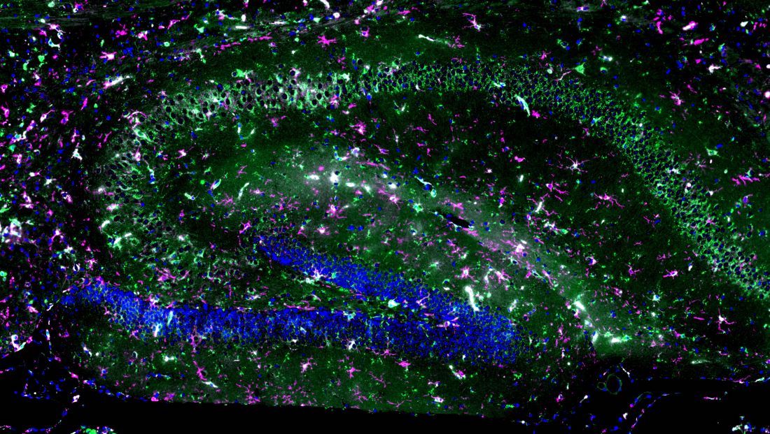 Immunostaining of the hippocampus of a mouse